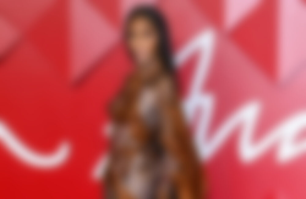 Winnie Harlow: Sie sollte nie ein Model sein