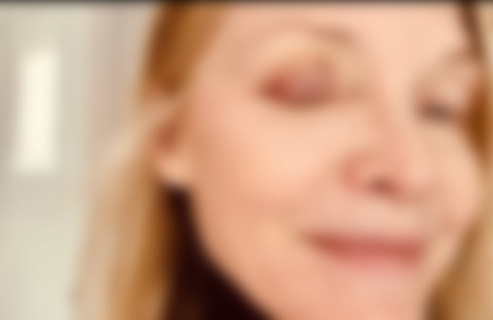 Michelle Pfeiffer: Blaues Auge vom Sport